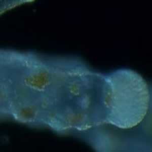 POLYP POLYP